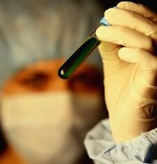 паразиттерге қалай тексеруден өту керек