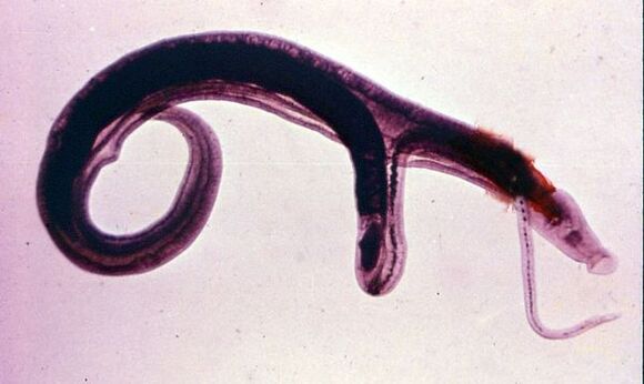 Шистосомалар ең таралған және қауіпті паразиттердің бірі болып табылады